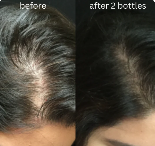 Hair Nectar By HerbCure