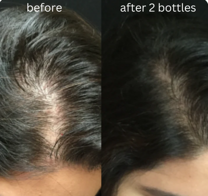 Hair Nectar By HerbCure