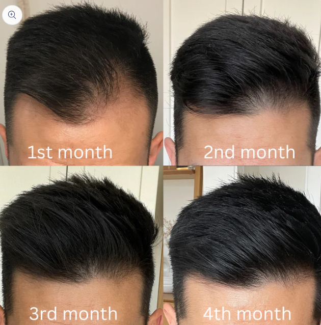 Hair Nectar By HerbCure